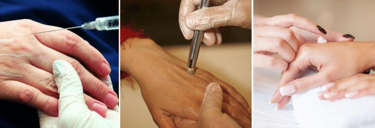 imagens de mulheres realizando procedimentos em suas mãos para evitar o envelhecimento